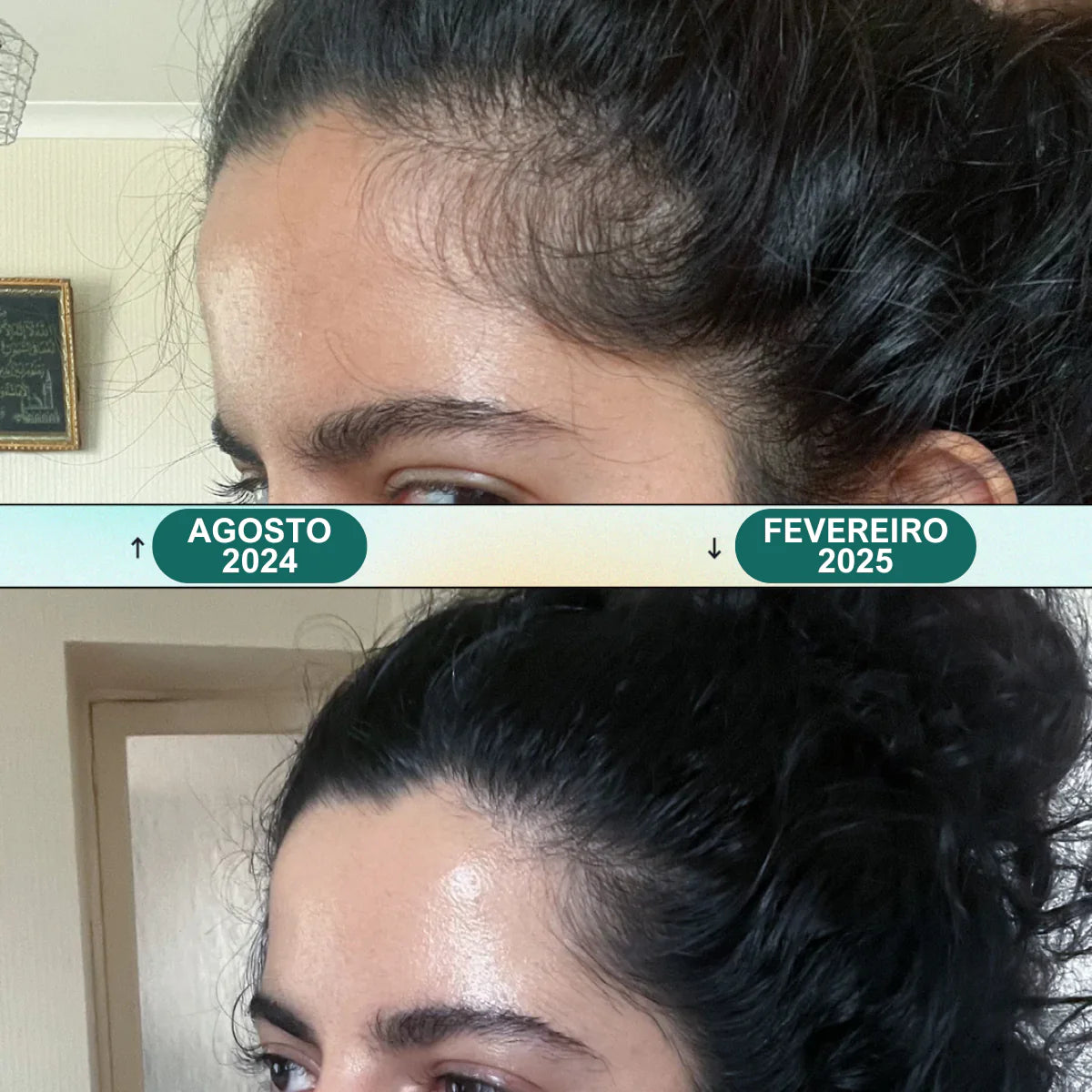 Massageador Elétrico para Couro Cabeludo
