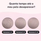 Depilador IPL Laser™