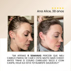 Repair Hair Therapy: Tratamento Antiquedas 3 em 1